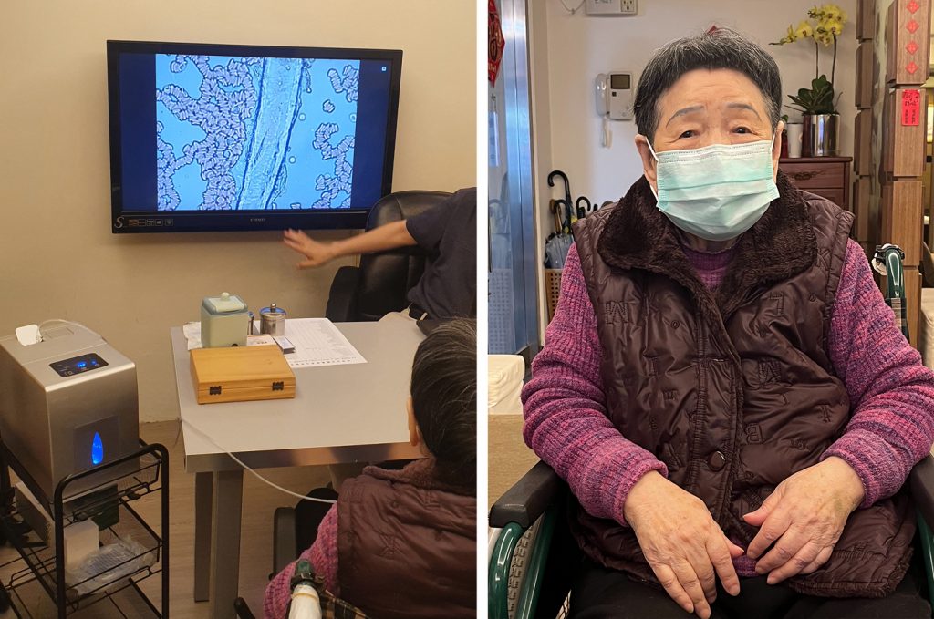 吸氫前後高倍活血鏡檢測